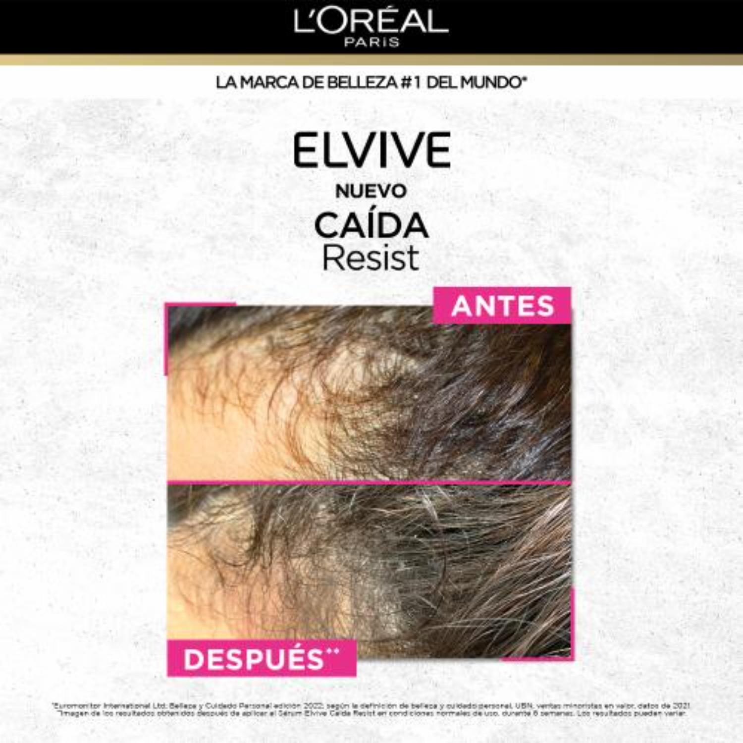 Acondicionador De Cabello Caída Resist Con Aminexil + Cafeína Para Cabello Quebradizo ELVIVE L’ORÉAL 370 Ml