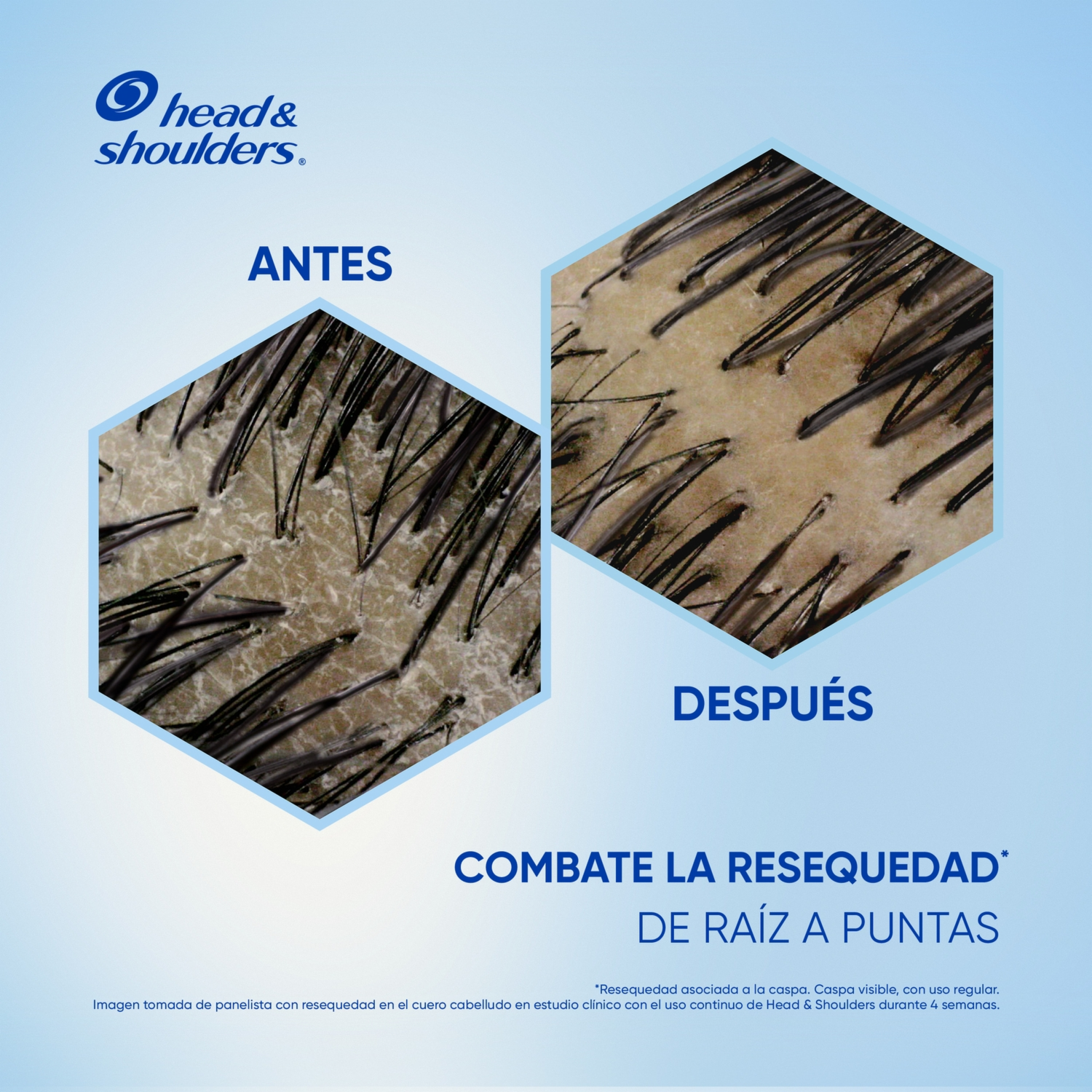 Shampoo De Cabello Anti-Resequedad Nutrición Diaria Miel Aceites Y Esenciales HEAD & SHOULDERS 180 Ml