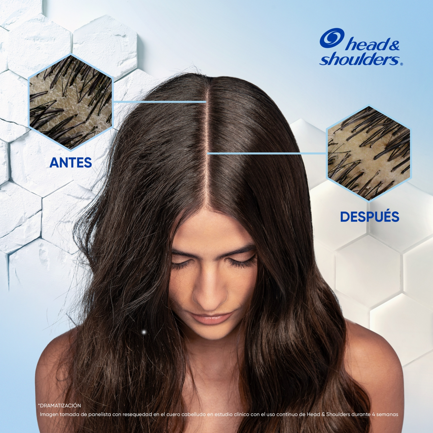 Shampoo De Cabello Anti-Resequedad Nutrición Diaria Miel Aceites Y Esenciales HEAD & SHOULDERS 180 Ml